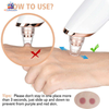 skincare blackhead removal device